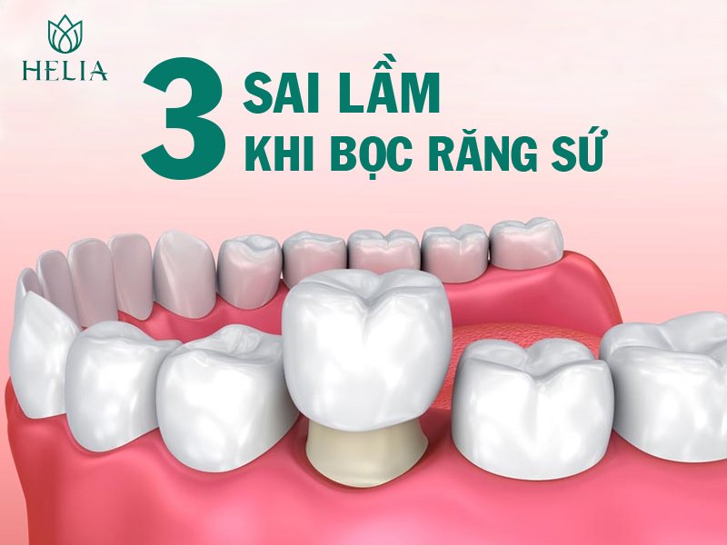 3 Sai lầm tai hại khi bọc răng sứ 3 sai lầm khi bọc răng sứ