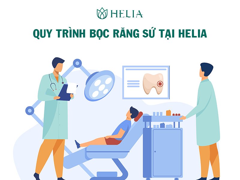 Những điều cần biết về răng sứ kim loại Quy trình 6 bước bọc răng sứ